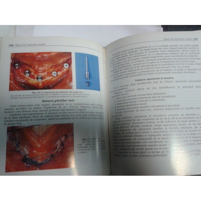 TRATAT DE IMPLANTOLOGIE ORALA -Ganuta,Bucur