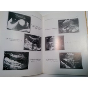 GHID PRACTIC DE ECOGRAFIE ABDOMINALA